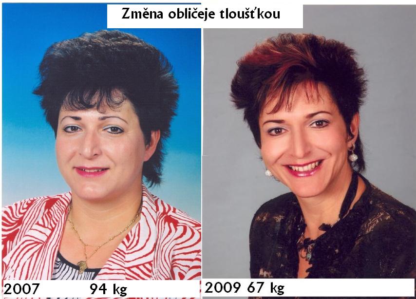 Oblicej 2007 94 kg a 2009 67 kg.jpg